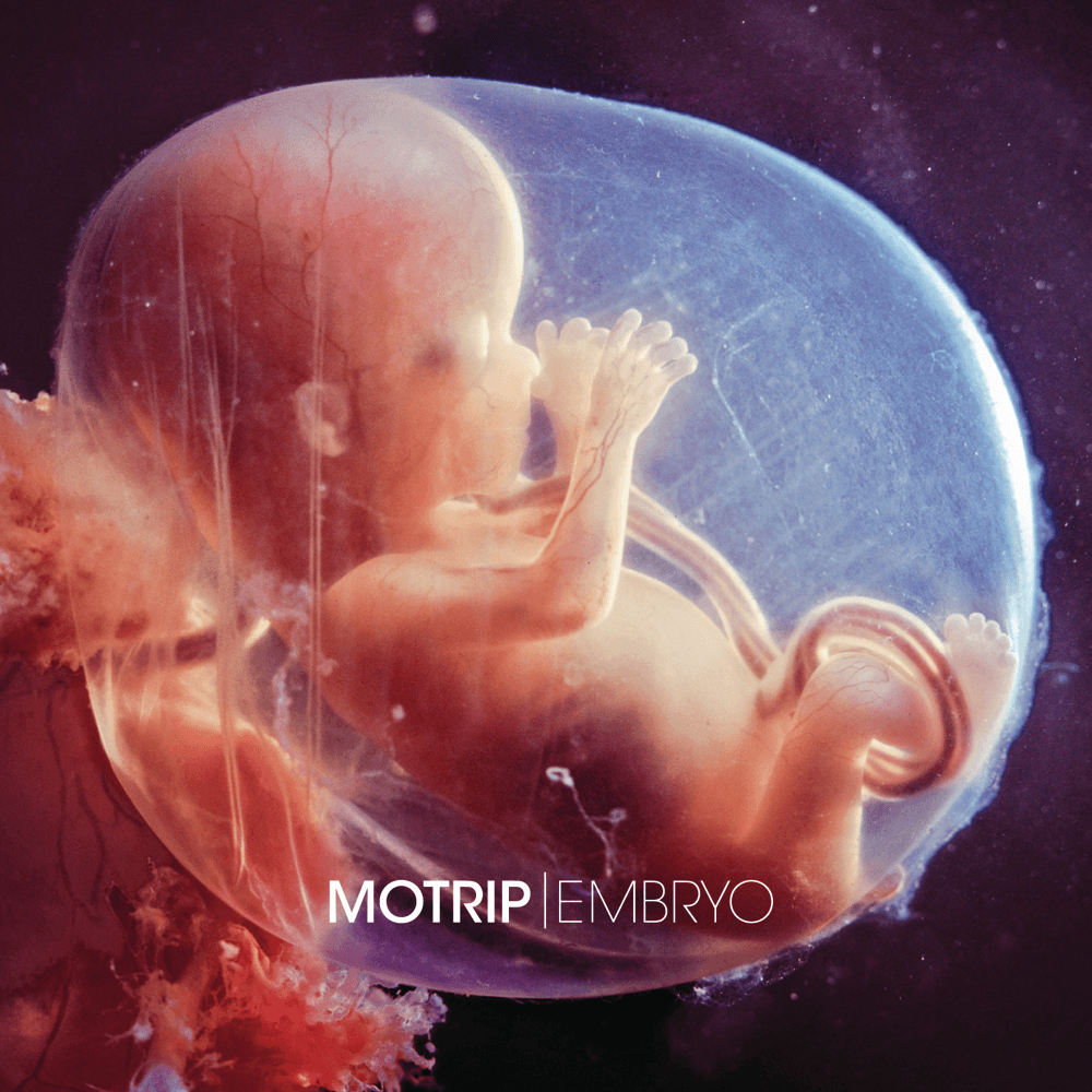 MoTrip - Embryo MoTrip - Embryo