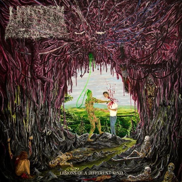 Undeath - Lesions Of A Different Kind Undeath - Lesions Of A Different Kind